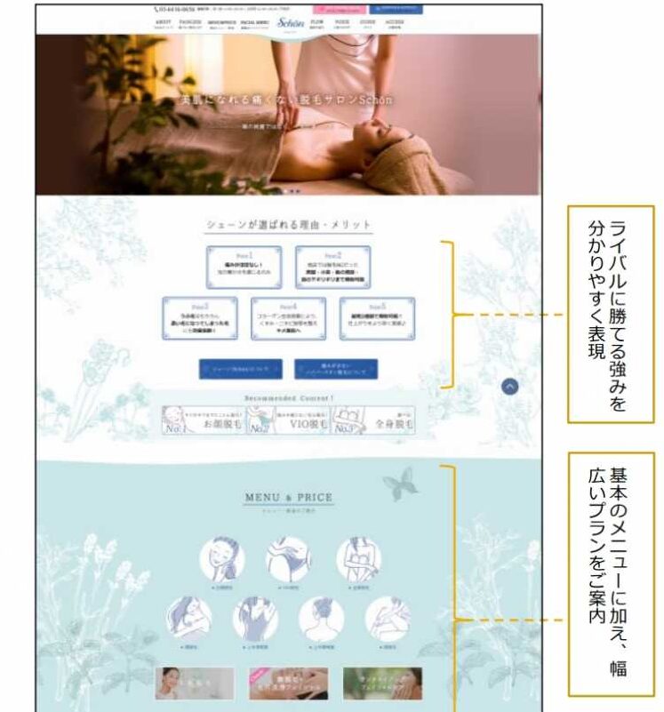 プライベート脱毛サロン シェーン様