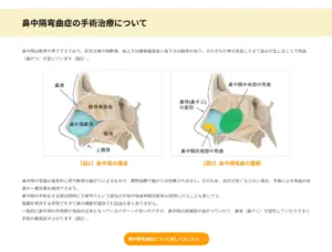 大櫛耳鼻咽喉科 はな・みみサージクリニック様｜ヘルスケアWebお客さまインタビュー